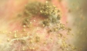 Аспергільоз на кукурудзі