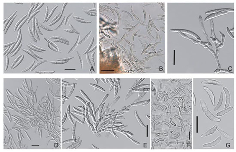 Мікроструктури снігової плісняви — Microdochium nivale (Fr.) Sumuels et Hallet. Syn.