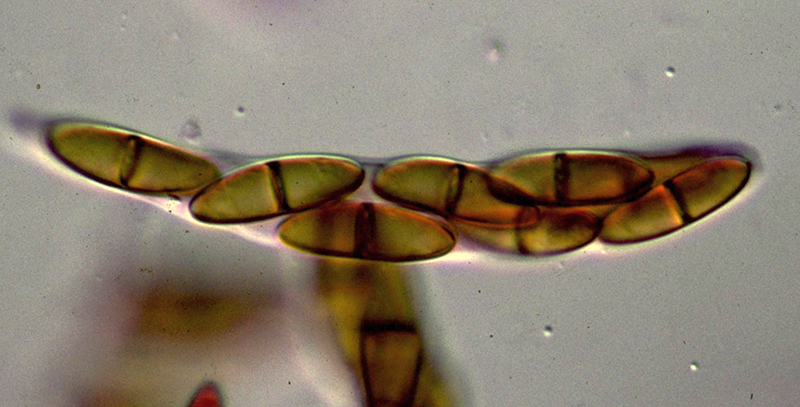 Мікрофотографія гібелліноза — Gibellina cerealis Pass