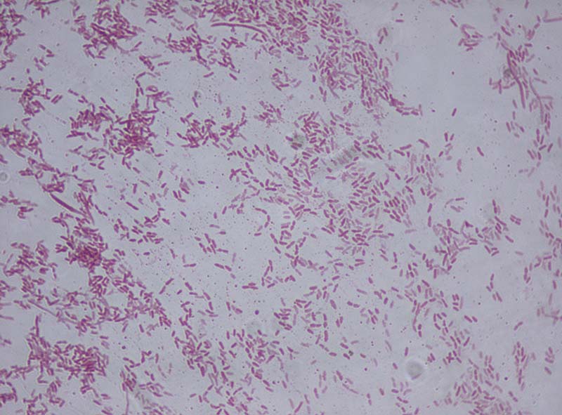 Бактерія Pseudomonas fluorescens (Фото: wikimedia.org)