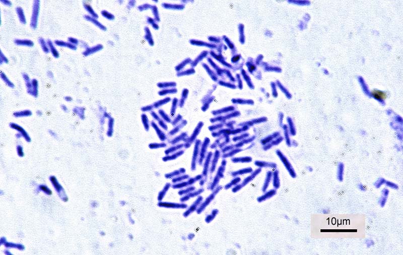 Бактерія Bacillus subtilis (Фото: wikipedia.org)