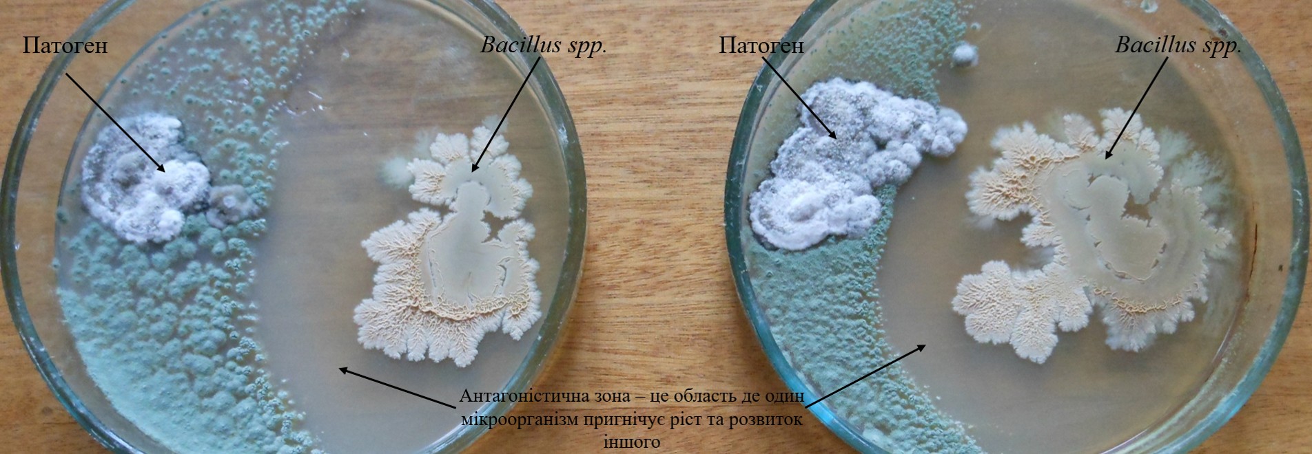 Приклад антагоністичної взаємодії бактерій роду Bacillus з патогеном